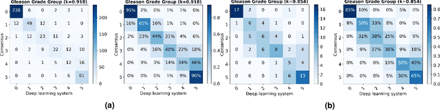 Figure 2 for Automated Gleason Grading of Prostate Biopsies using Deep Learning