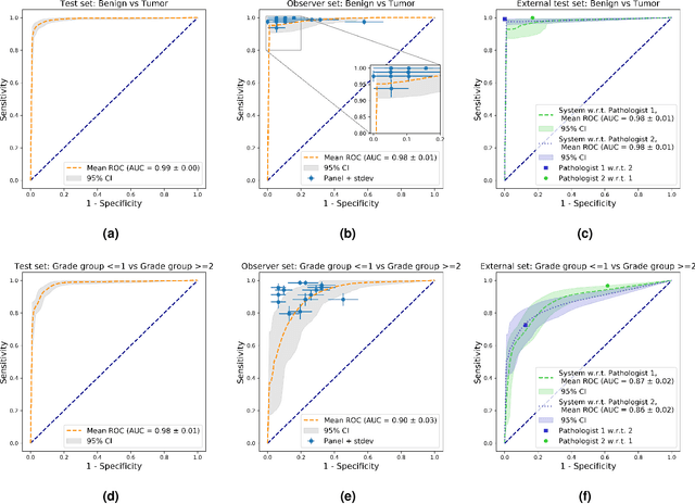 Figure 3 for Automated Gleason Grading of Prostate Biopsies using Deep Learning