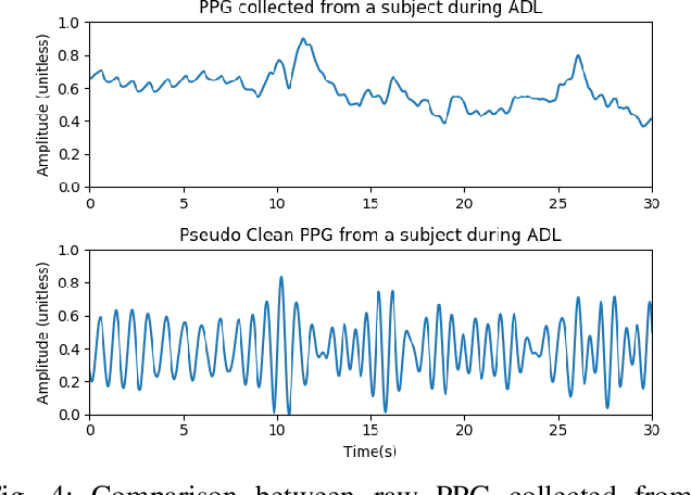 Figure 4 for Motion Artifact Reduction In Photoplethysmography For Reliable Signal Selection