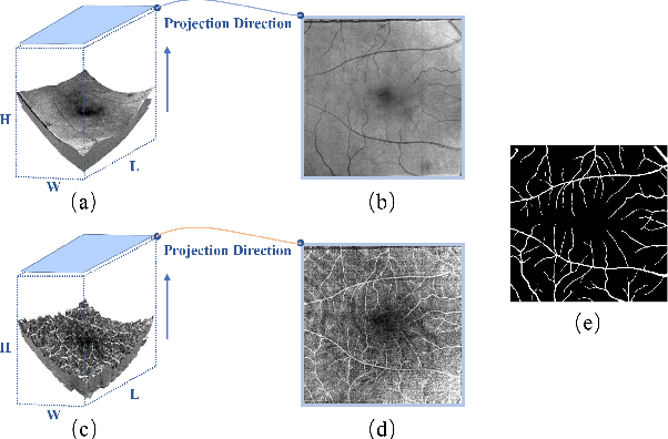 Figure 1 for PAENet: A Progressive Attention-Enhanced Network for 3D to 2D Retinal Vessel Segmentation