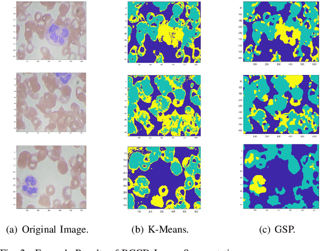 Figure 2 for Graph Signal Processing over Multilayer Networks -- Part II: Useful Tools and Practical Applications