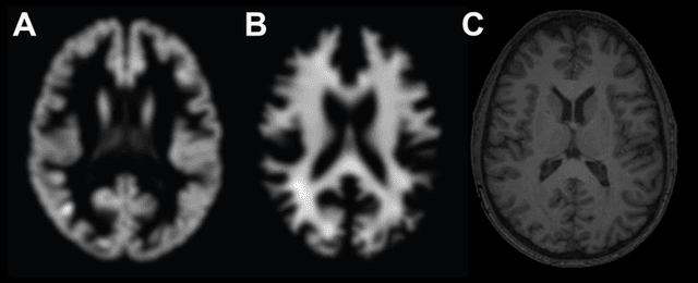 Figure 1 for Predicting brain age with deep learning from raw imaging data results in a reliable and heritable biomarker