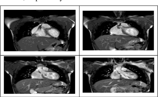 Figure 3 for FCM-DNN: diagnosing coronary artery disease by deep accuracy Fuzzy C-Means clustering model