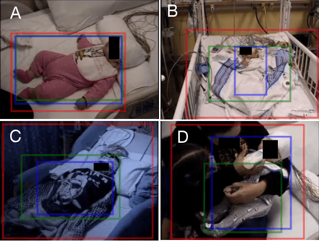 Figure 3 for Automated Detection of Patients in Hospital Video Recordings