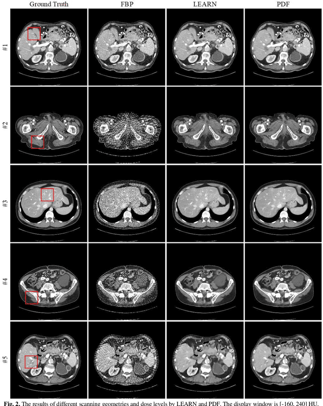 Figure 2 for CT Reconstruction with PDF: Parameter-Dependent Framework for Multiple Scanning Geometries and Dose Levels