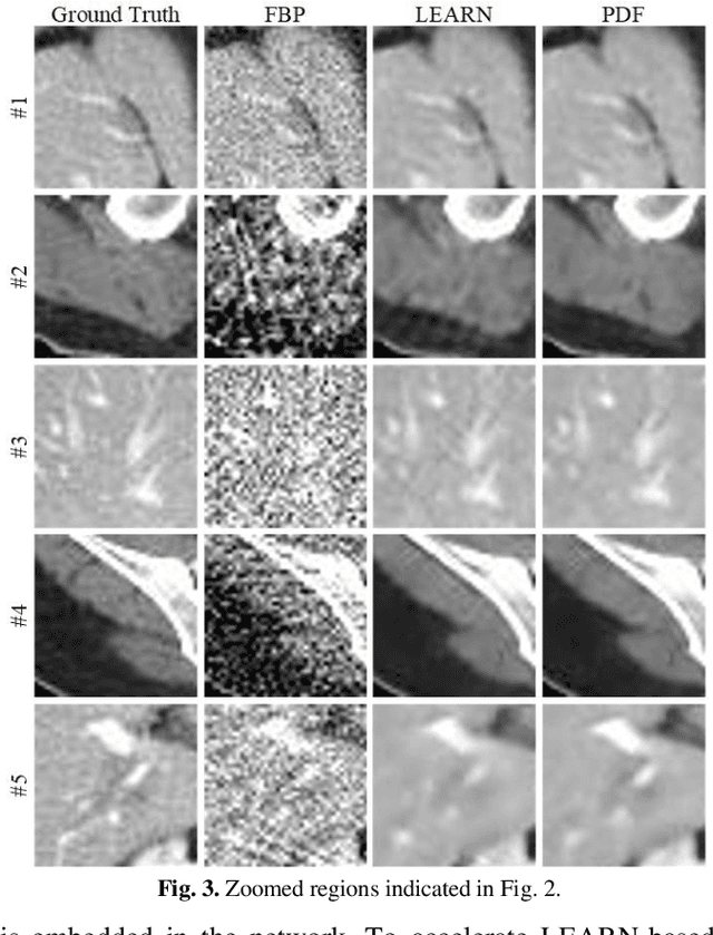 Figure 3 for CT Reconstruction with PDF: Parameter-Dependent Framework for Multiple Scanning Geometries and Dose Levels