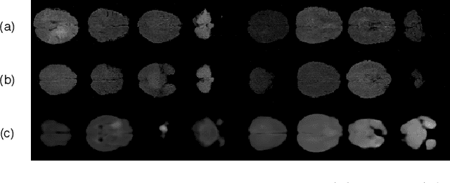 Figure 2 for GLOWin: A Flow-based Invertible Generative Framework for Learning Disentangled Feature Representations in Medical Images