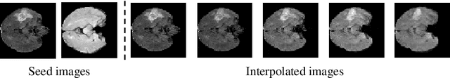 Figure 4 for GLOWin: A Flow-based Invertible Generative Framework for Learning Disentangled Feature Representations in Medical Images