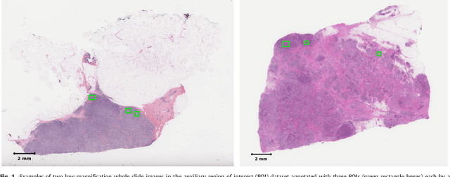 Figure 2 for Predicting breast tumor proliferation from whole-slide images: the TUPAC16 challenge