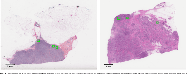 Figure 2 for Predicting breast tumor proliferation from whole-slide images: the TUPAC16 challenge