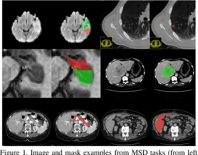 Figure 1 for C2FNAS: Coarse-to-Fine Neural Architecture Search for 3D Medical Image Segmentation