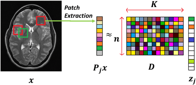 Figure 2 for Image Reconstruction: From Sparsity to Data-adaptive Methods and Machine Learning