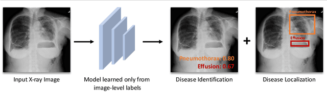 Figure 1 for Thoracic Disease Identification and Localization using Distance Learning and Region Verification