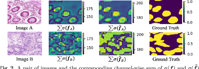 Figure 3 for Pairwise Relation Learning for Semi-supervised Gland Segmentation