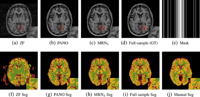 Figure 3 for Joint CS-MRI Reconstruction and Segmentation with a Unified Deep Network