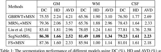 Figure 2 for Joint CS-MRI Reconstruction and Segmentation with a Unified Deep Network