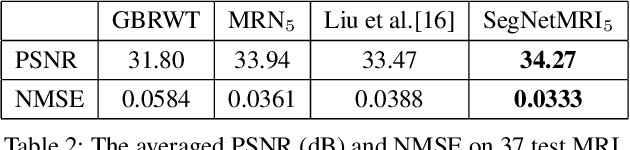 Figure 4 for Joint CS-MRI Reconstruction and Segmentation with a Unified Deep Network