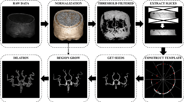 Figure 4 for An Automatic Detection Method Of Cerebral Aneurysms In Time-Of-Flight Magnetic Resonance Angiography Images Based On Attention 3D U-Net