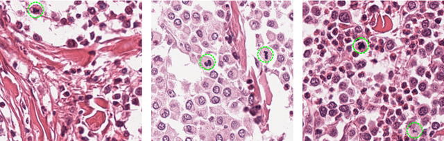 Figure 1 for Field of Interest Prediction for Computer-Aided Mitotic Count