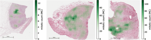 Figure 3 for Field of Interest Prediction for Computer-Aided Mitotic Count