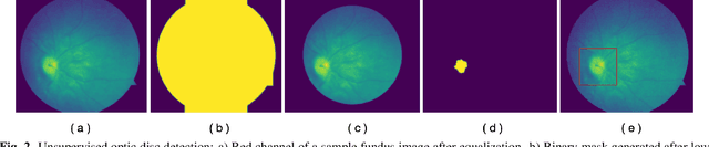 Figure 3 for Automating Detection of Papilledema in Pediatric Fundus Images with Explainable Machine Learning