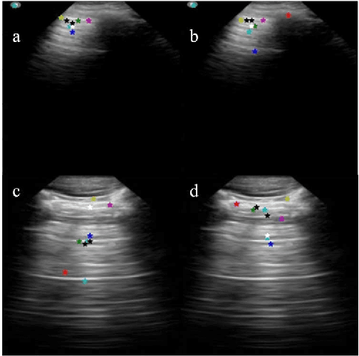 Figure 3 for Learning the Imaging Landmarks: Unsupervised Key point Detection in Lung Ultrasound Videos