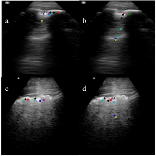Figure 4 for Learning the Imaging Landmarks: Unsupervised Key point Detection in Lung Ultrasound Videos