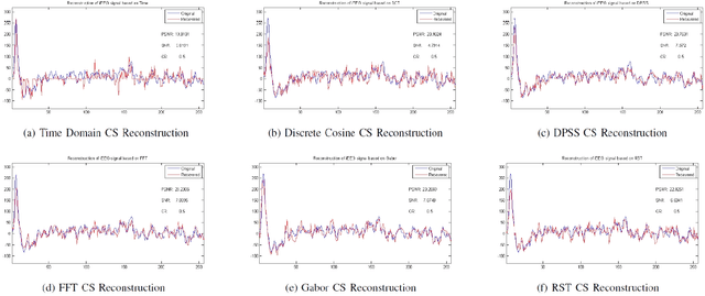 Figure 2 for Study on Compressed Sensing of Action Potential