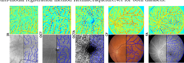 Figure 3 for A Keypoint Detection and Description Network Based on the Vessel Structure for Multi-Modal Retinal Image Registration
