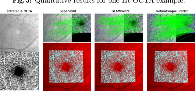 Figure 4 for A Keypoint Detection and Description Network Based on the Vessel Structure for Multi-Modal Retinal Image Registration