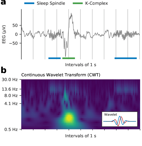 Figure 1 for RED: Deep Recurrent Neural Networks for Sleep EEG Event Detection