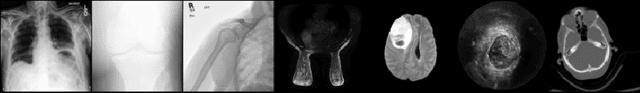 Figure 1 for The Intrinsic Manifolds of Radiological Images and their Role in Deep Learning