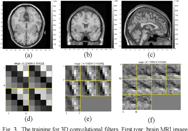 Figure 3 for Penalized-likelihood PET Image Reconstruction Using 3D Structural Convolutional Sparse Coding