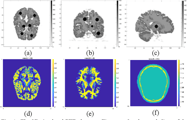 Figure 4 for Penalized-likelihood PET Image Reconstruction Using 3D Structural Convolutional Sparse Coding