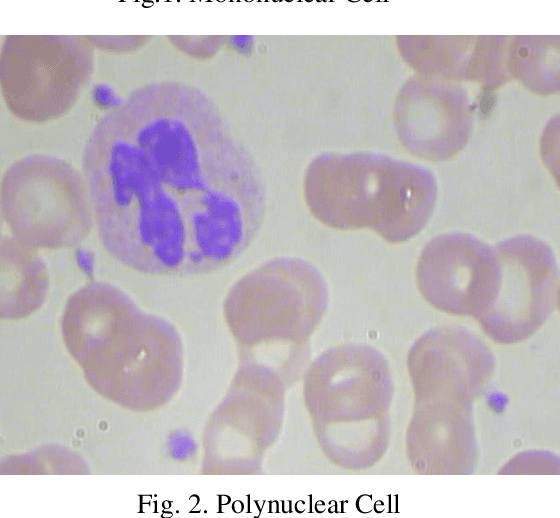 Figure 2 for Pathological Analysis of Blood Cells Using Deep Learning Techniques