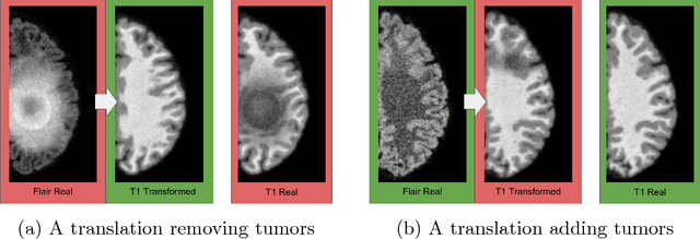 Figure 1 for Distribution Matching Losses Can Hallucinate Features in Medical Image Translation