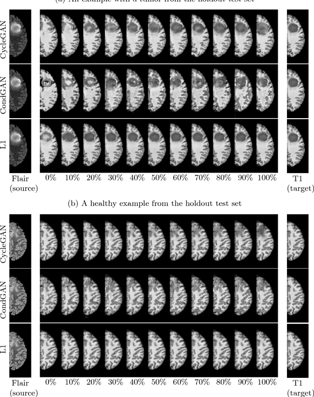 Figure 4 for Distribution Matching Losses Can Hallucinate Features in Medical Image Translation