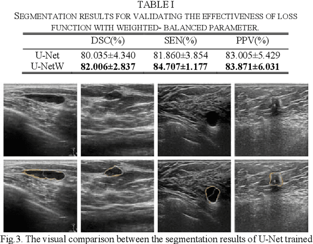 Figure 1 for CF2-Net: Coarse-to-Fine Fusion Convolutional Network for Breast Ultrasound Image Segmentation