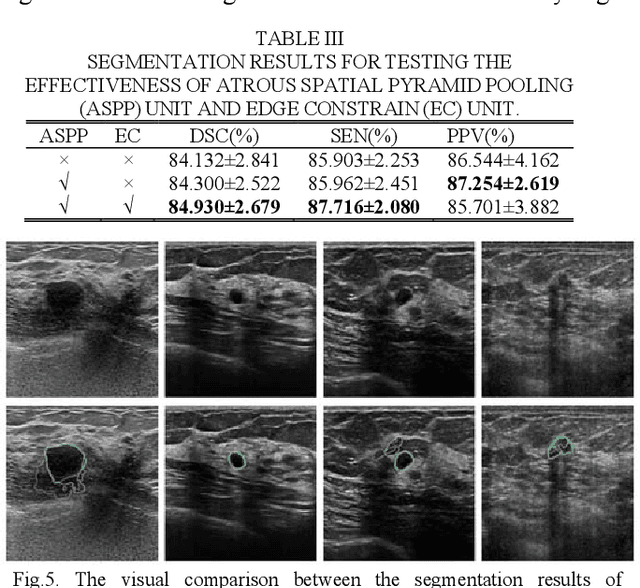 Figure 3 for CF2-Net: Coarse-to-Fine Fusion Convolutional Network for Breast Ultrasound Image Segmentation