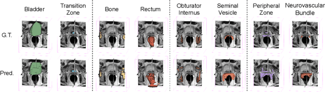 Figure 4 for Few-shot image segmentation for cross-institution male pelvic organs using registration-assisted prototypical learning
