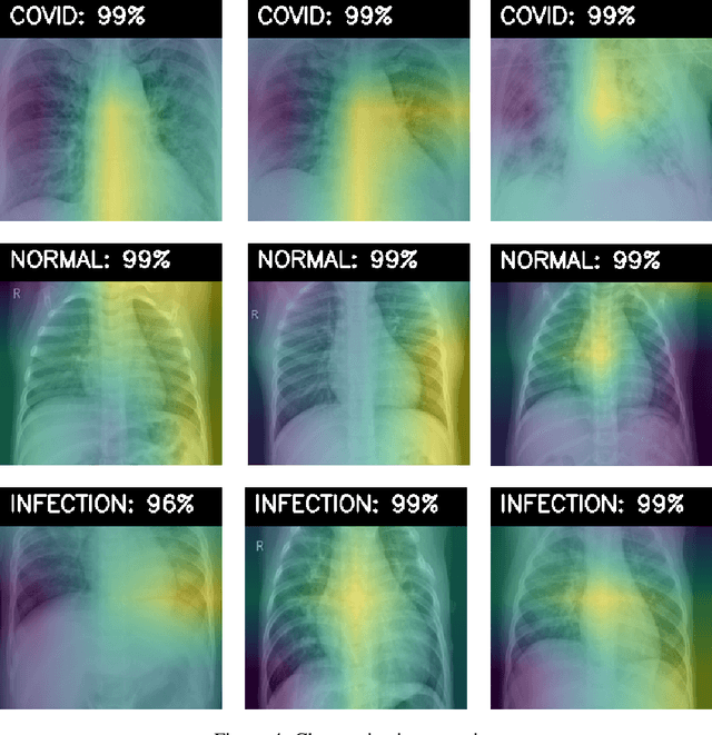 Figure 4 for Automatic Detection of COVID-19 Cases on X-ray images Using Convolutional Neural Networks