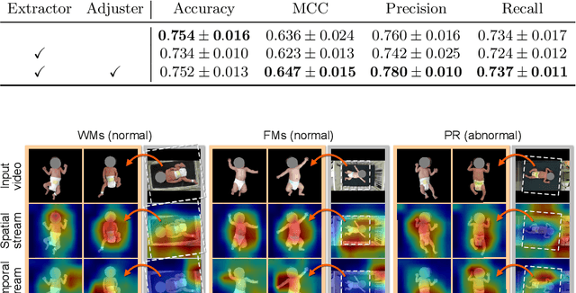 Figure 3 for Automated Classification of General Movements in Infants Using a Two-stream Spatiotemporal Fusion Network