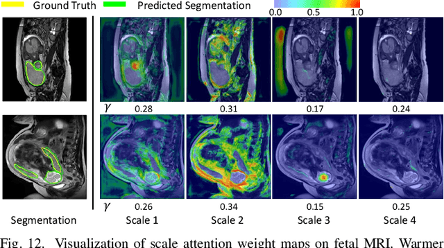 Figure 4 for CA-Net: Comprehensive Attention Convolutional Neural Networks for Explainable Medical Image Segmentation