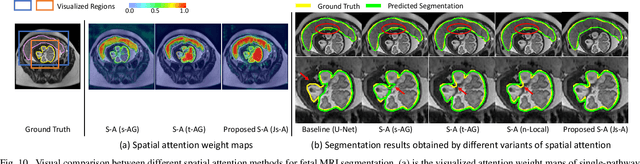 Figure 2 for CA-Net: Comprehensive Attention Convolutional Neural Networks for Explainable Medical Image Segmentation