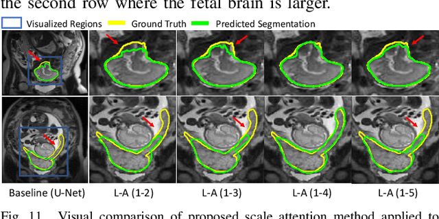 Figure 3 for CA-Net: Comprehensive Attention Convolutional Neural Networks for Explainable Medical Image Segmentation
