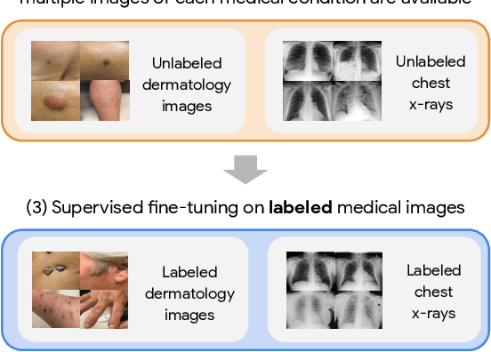 Figure 1 for Big Self-Supervised Models Advance Medical Image Classification