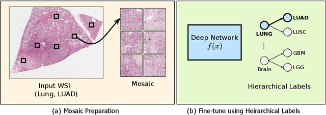 Figure 1 for Pay Attention with Focus: A Novel Learning Scheme for Classification of Whole Slide Images