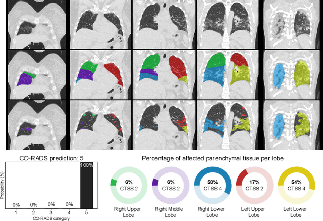 Figure 3 for A review of deep learning in medical imaging: Image traits, technology trends, case studies with progress highlights, and future promises