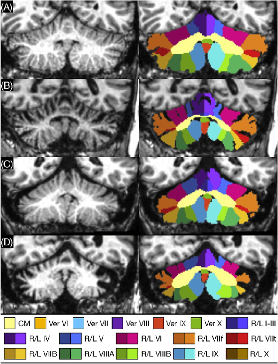 Figure 4 for A review of deep learning in medical imaging: Image traits, technology trends, case studies with progress highlights, and future promises