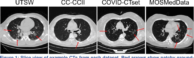 Figure 1 for Deep learning-based COVID-19 pneumonia classification using chest CT images: model generalizability